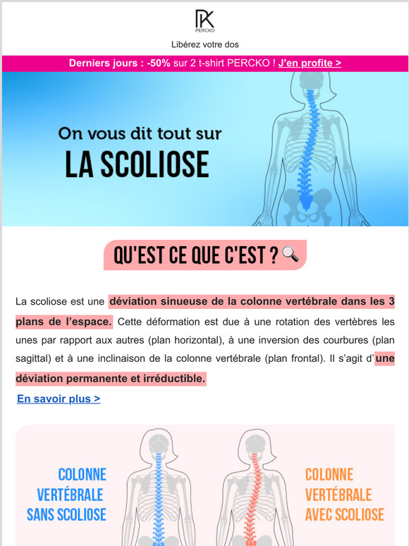 Percko Es Tout Savoir Sur La Scoliose Milled