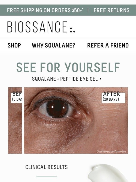 biossance eye cream before and after