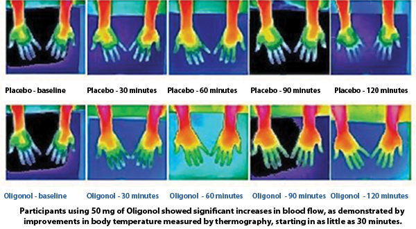 Examples of blood flow improvment with Nerve Protect Plus