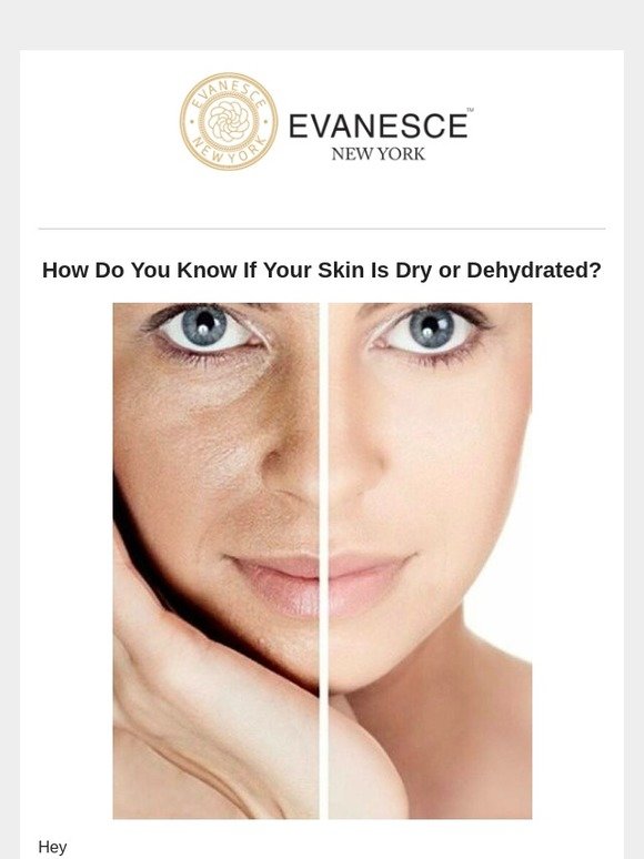 evanesce-new-york-week-46-email-1-how-do-you-know-if-your-skin-is