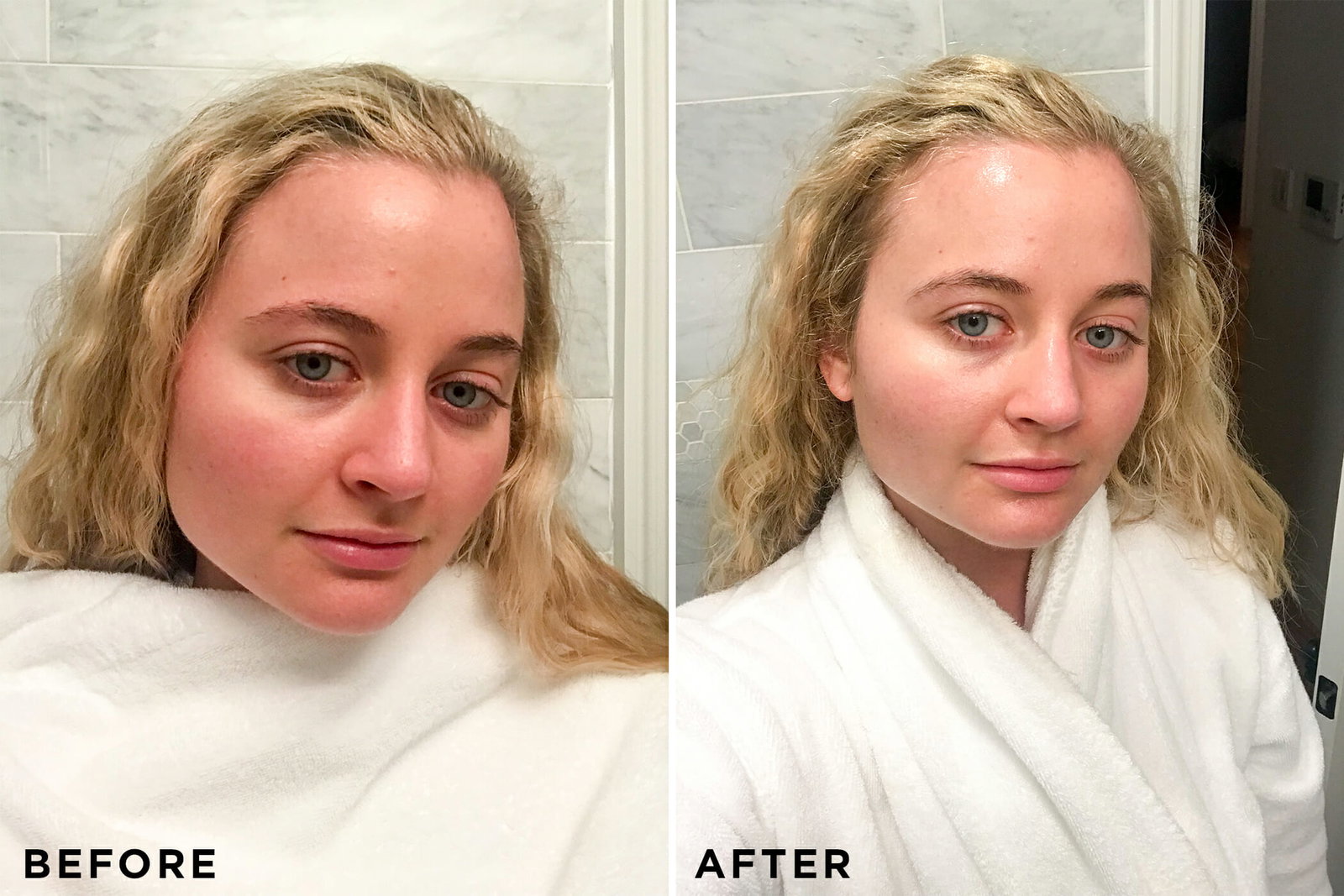 may-lindstrom-after-Reducing-redness-selfies-Man-Repeller-December-2018.jpg