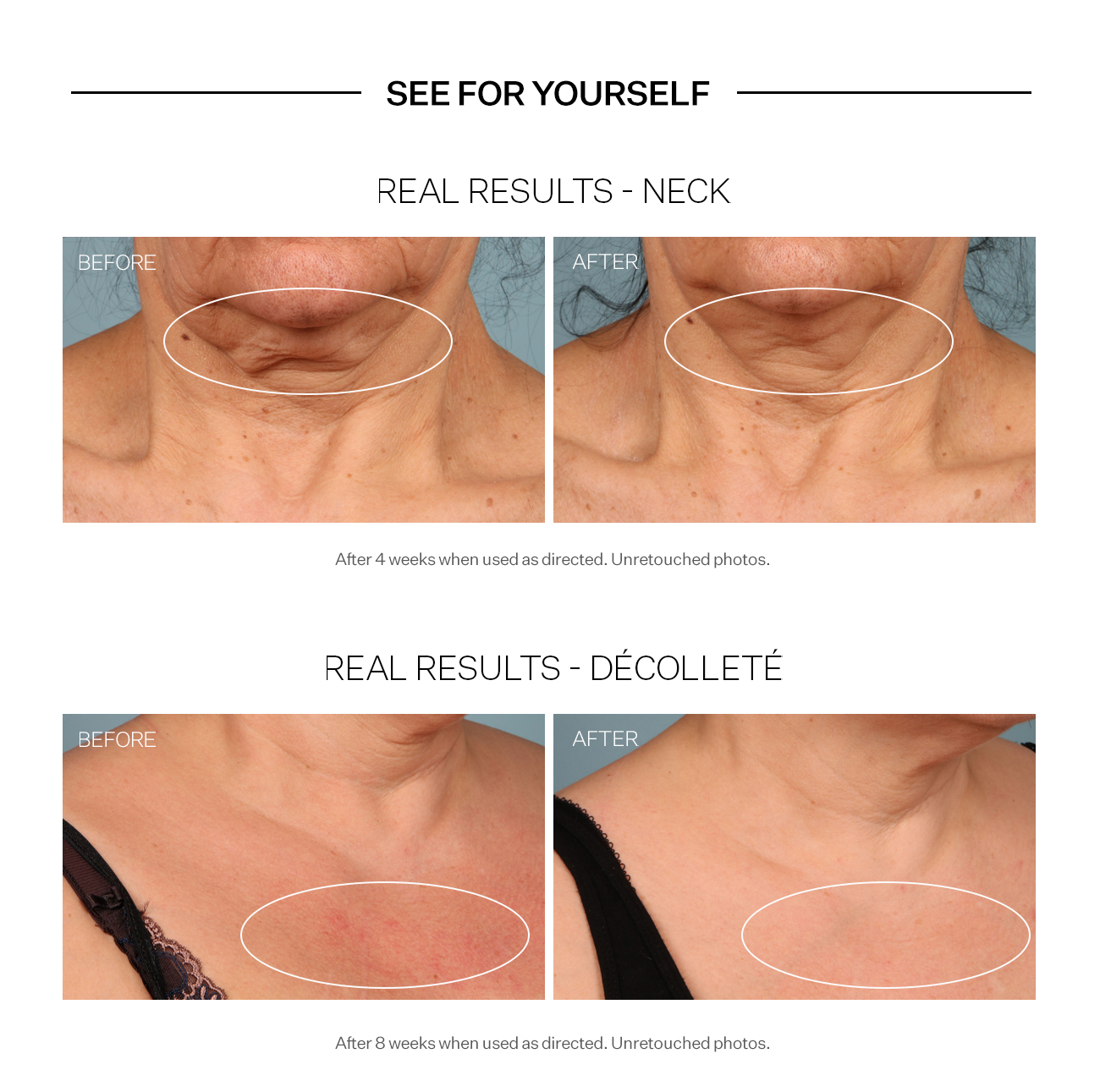 strivectin neck cream before and after photos