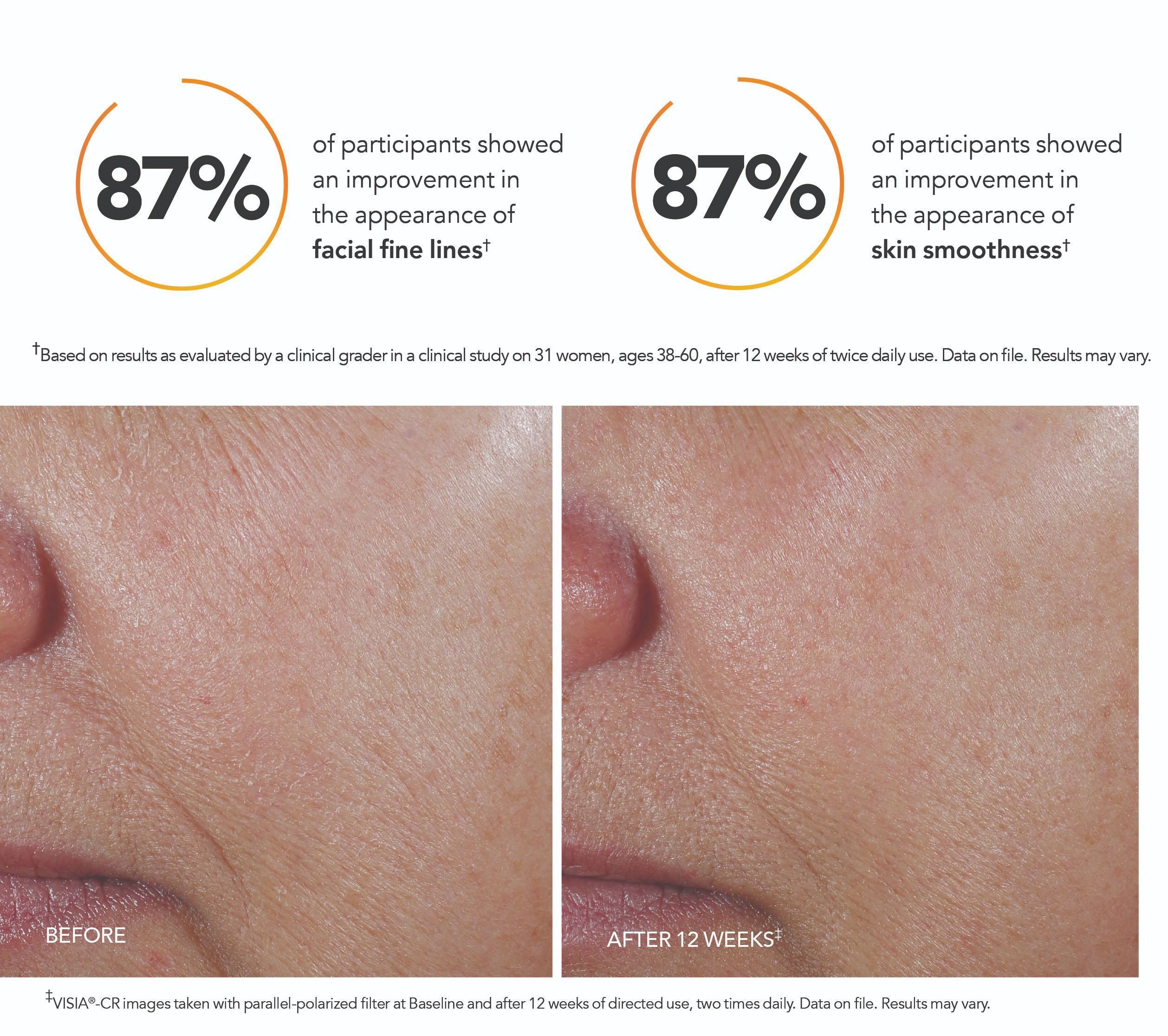 revision c correcting complex