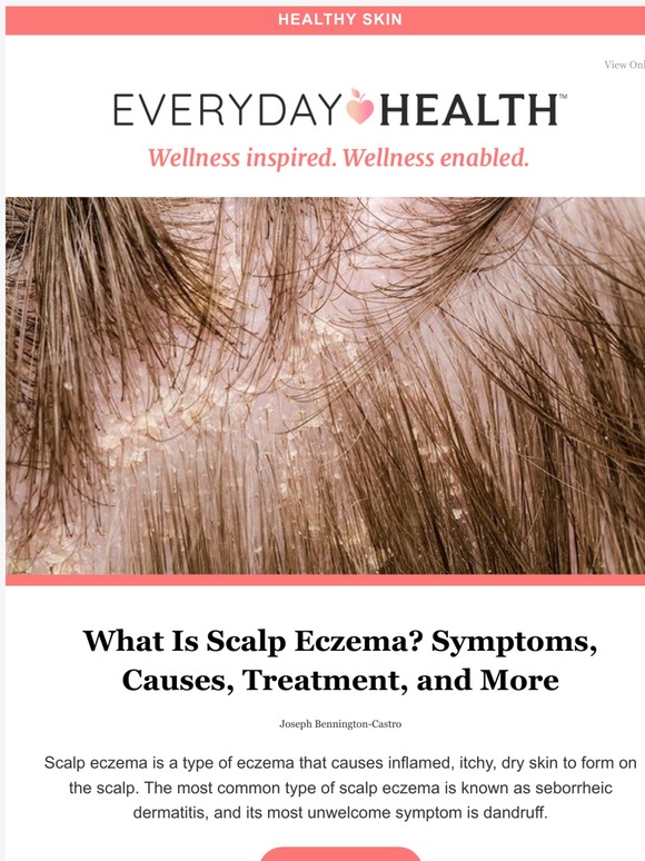 LIfescript What Is Scalp Eczema? Symptoms, Causes, Treatment, and More