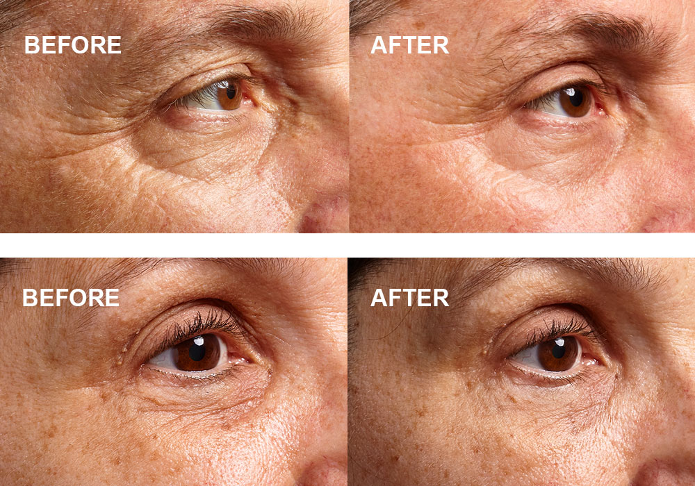 b nourished eye cream