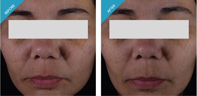 advanced brightening uv defense skinceuticals