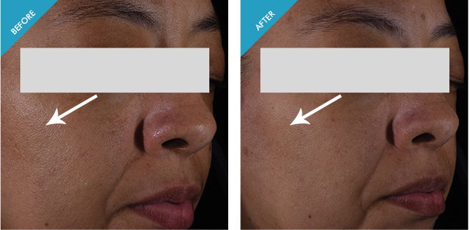 advanced brightening uv defense skinceuticals