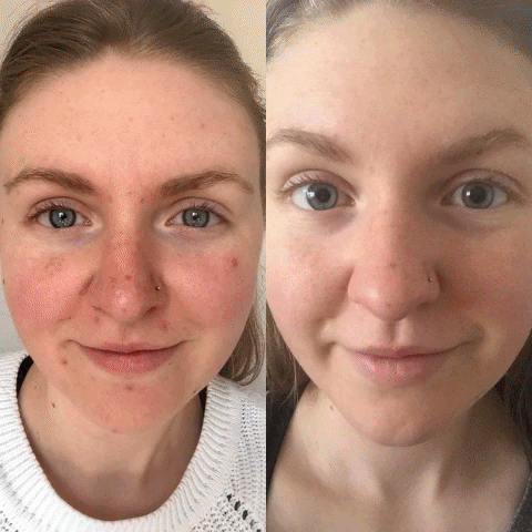 UpCircle Beauty: Before and Afters ✨ | Milled