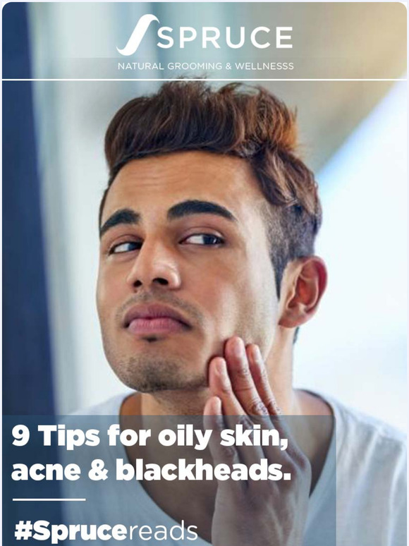 Struggling with Oily Skin or Blackheads? Here are 9 Tips To Help!