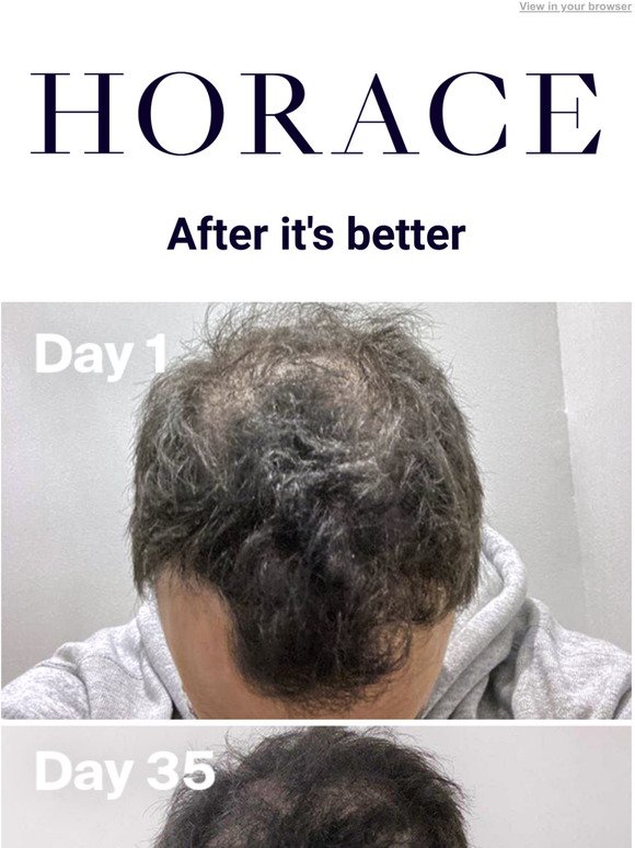 Before and After our Anti-Hair Loss Serum