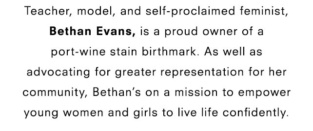 Teacher, model, and self-proclaimed feminist, Bethan Evans, is a proud owner of a port-wine stain birthmark. As well as advocating for greater representation for her community, Bethan’s on a mission to empower young women and girls to live life confidently.