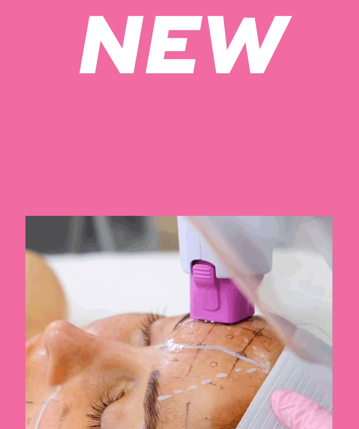 LaserAway New Treatment Packages Are Here! Milled