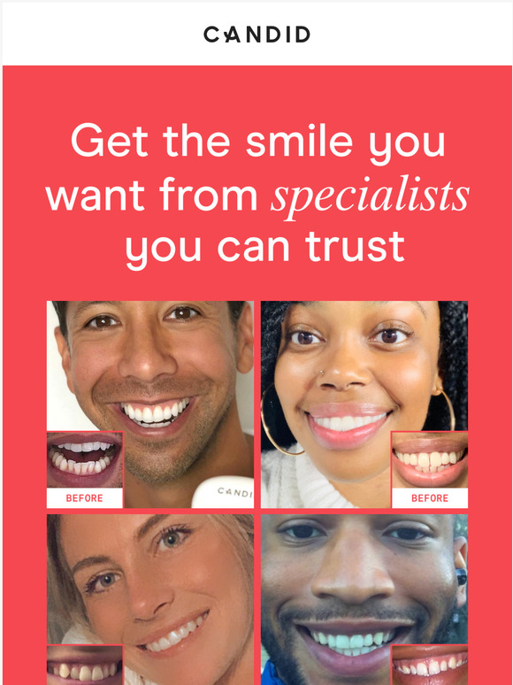 Straighten your smile the safe way