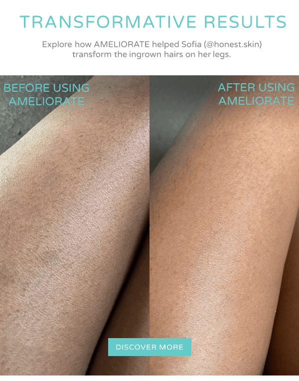 Transformative Results with AMELIORATE