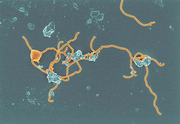 Coloured scanning electron micrograph of <i>Prometheoarchaeum syntrophicum archaea</i>
