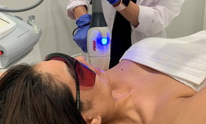 Up to 76% Off Laser Hair Removal at Renew U MediSpa