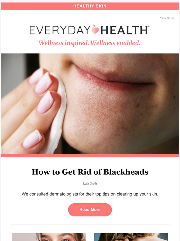 How to Get Rid of Blackheads