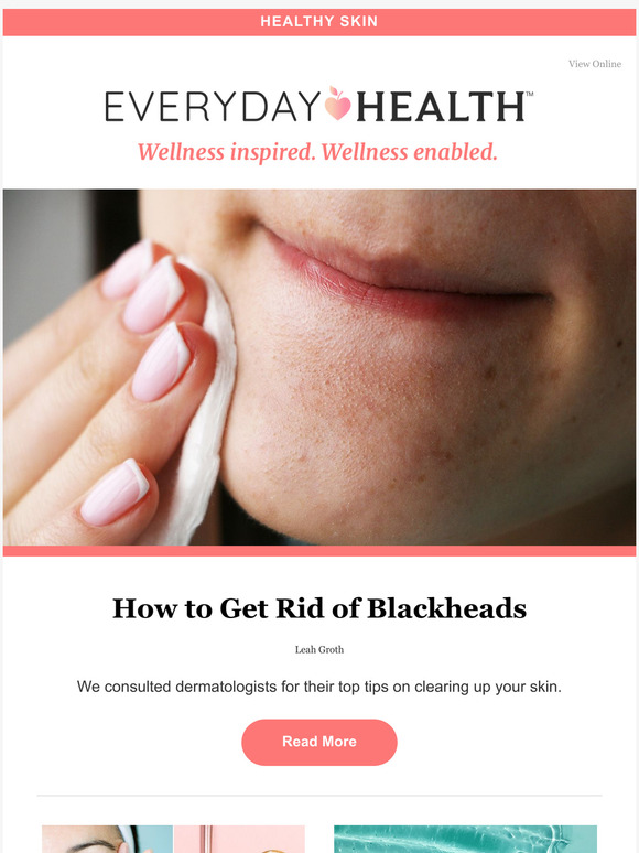 How to Get Rid of Blackheads