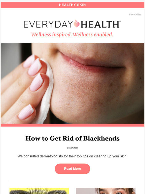 How to Get Rid of Blackheads