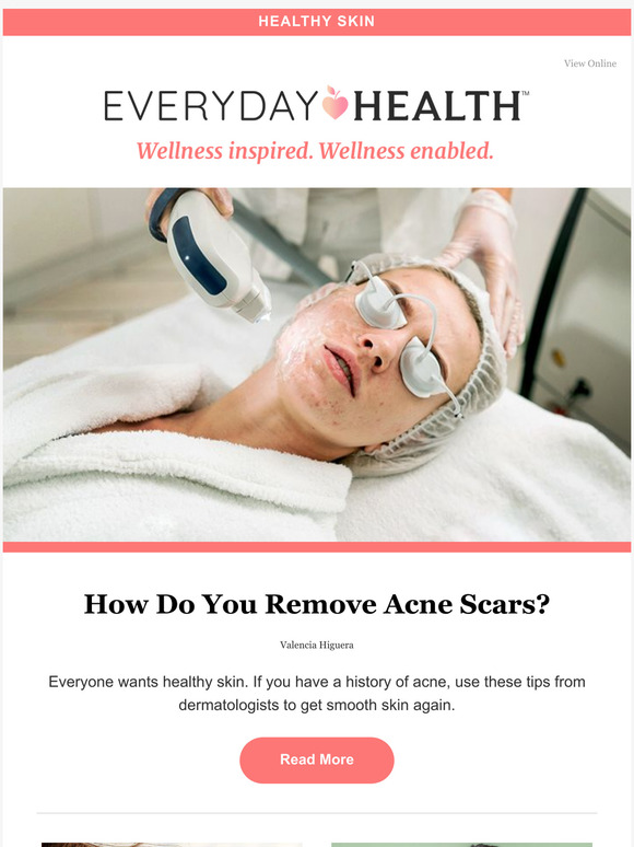 How Do You Remove Acne Scars?