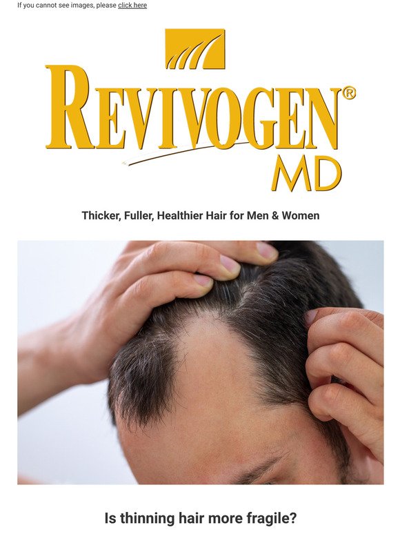 Is Thinning Hair More Fragile?
