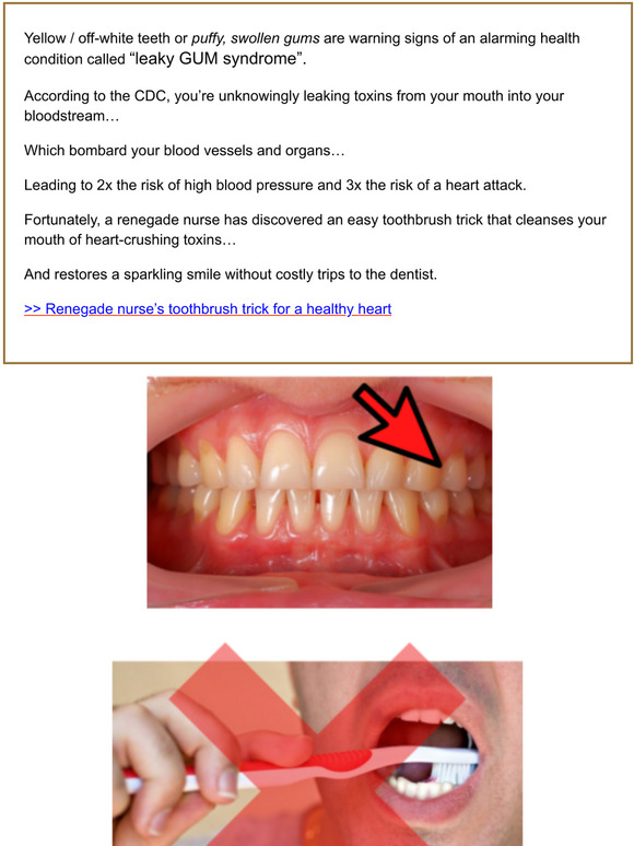 Primal Life Organics: Re: , Warnings signs of leaky GUM syndrome | Milled