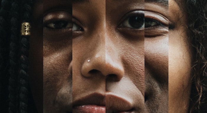 Technology For Detecting Skin Cancer Is Forging Ahead — But Not For People Of Color, Apparently | Mic