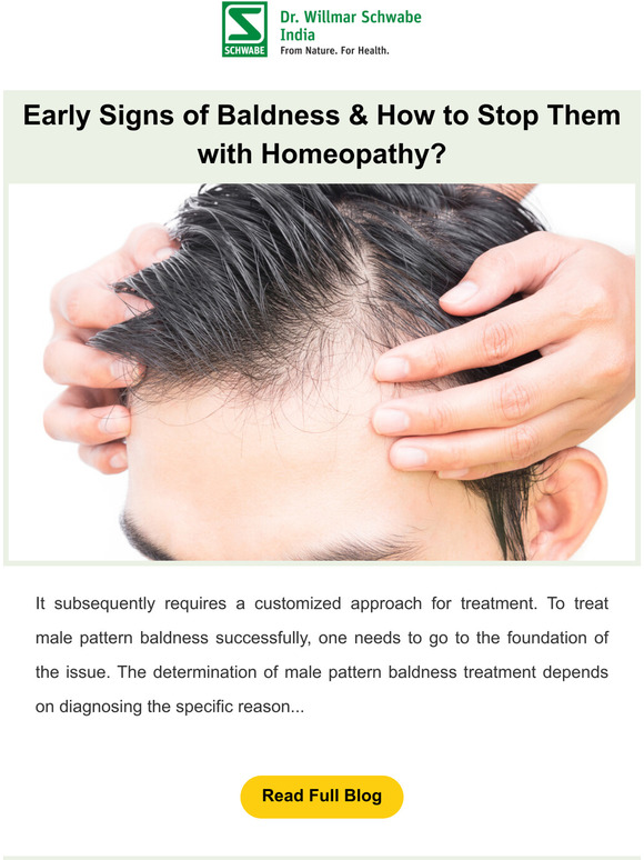 Read Now: Early Signs of Baldness & How to Stop Them with Homeopathy?