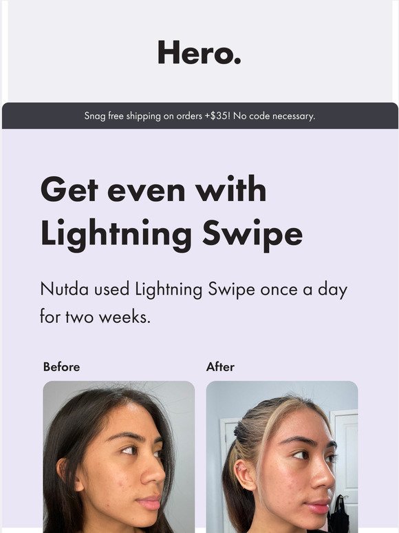 Uneven skin tone? Dark spots? Theres Lightning Swipe for that
