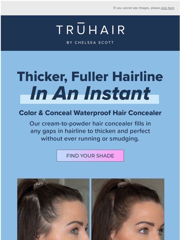 Get a fuller hairline now.