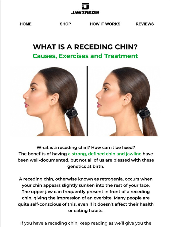 Jawzrsize What You Need To Know About Receding Chins! Milled