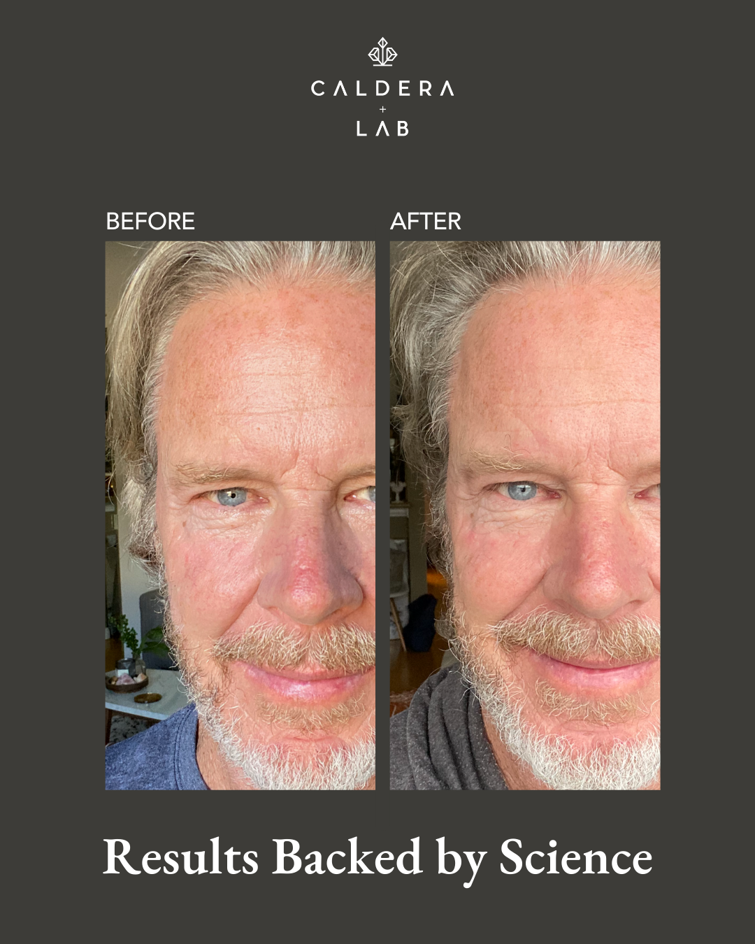 Before and After