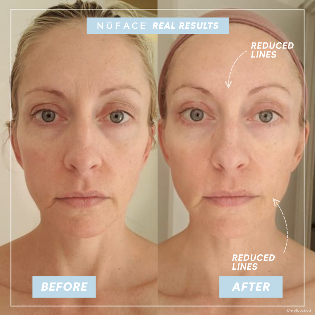 Before and After Results after using the 5 Minute Lift Routine