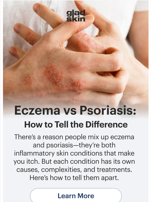 Gladskin Eczema vs Psoriasis How to Tell the Difference Milled