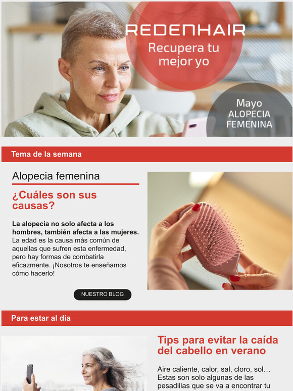 No ms alopecia femenina!