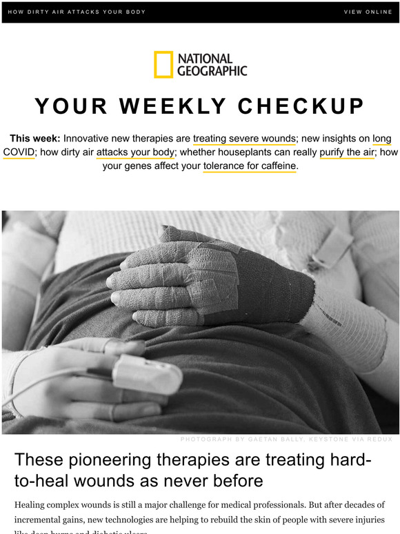 National Geographic Cuttingedge treatments for hardtoheal wounds