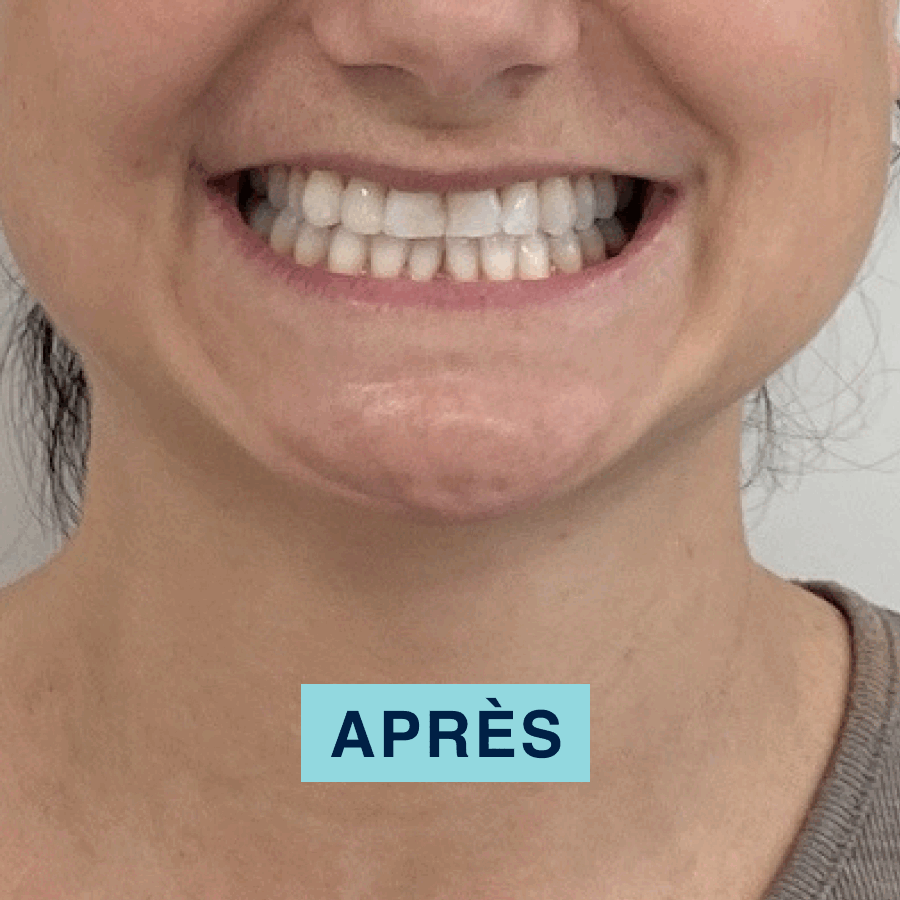 Chargement en cours...