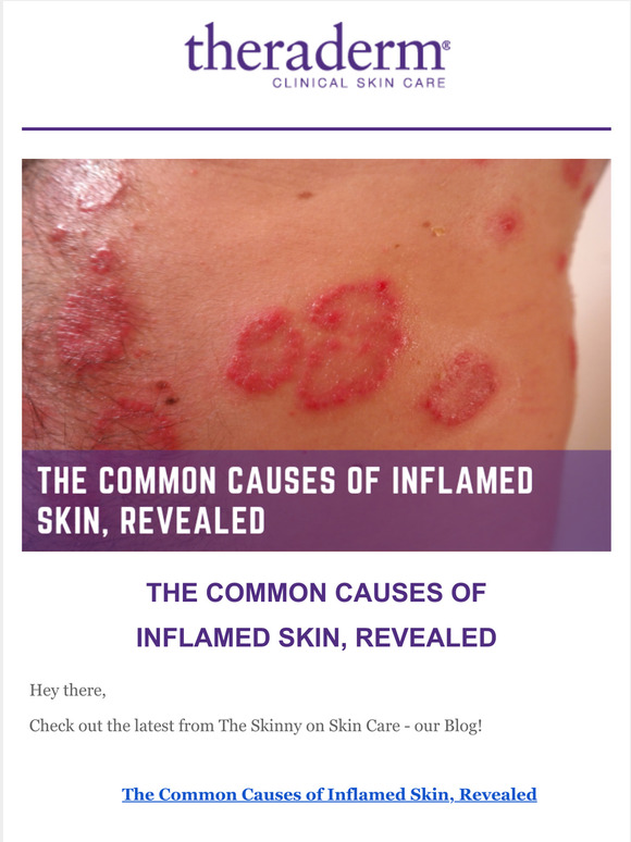 Therapon Skin Health How to Fix Sun Damaged Skin A Guide More from