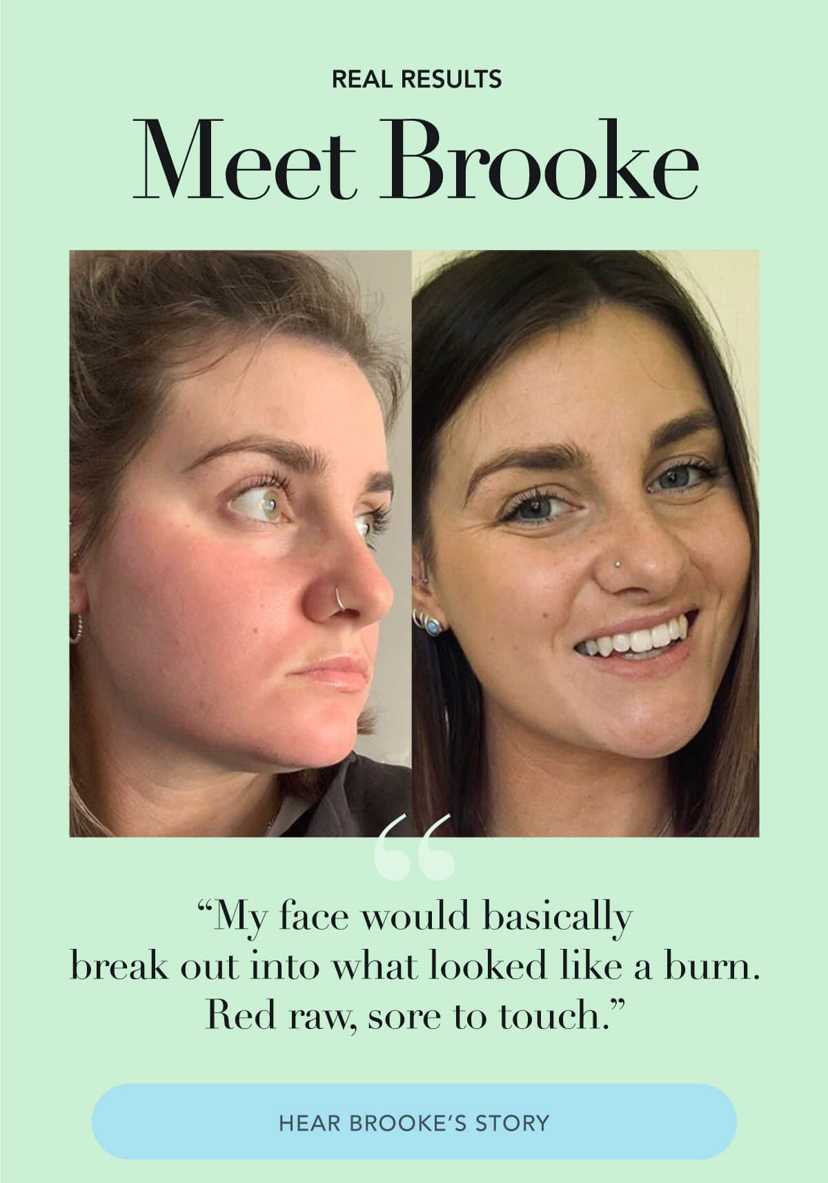 Meet Brooke