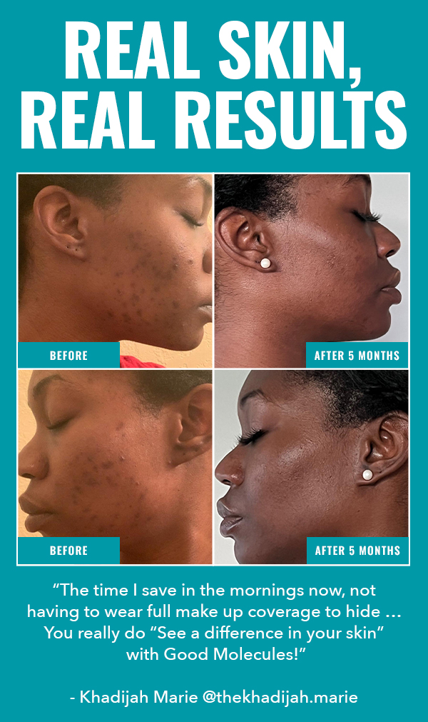 Good Molecules How To Fade Blemish Scars 😍 Milled