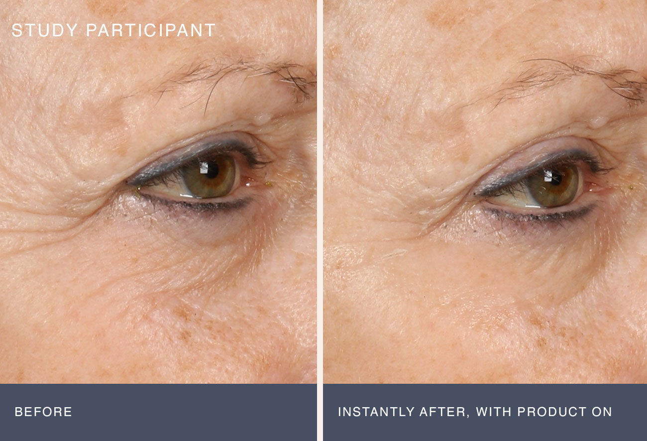 Study Participant Before and After