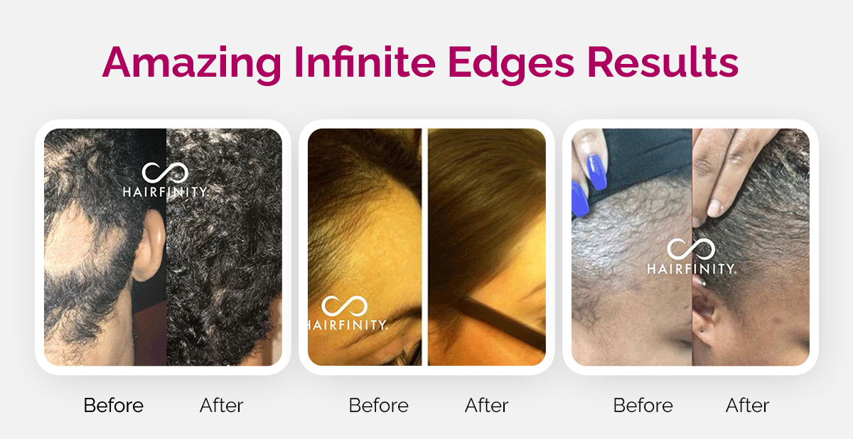 Hairfinity The ONE Serum You Need for Your Edges😍 Milled