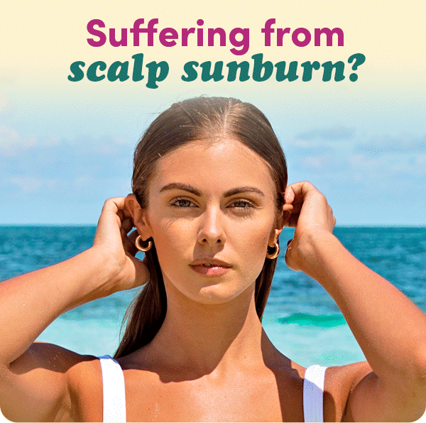 Scalp Sunburn