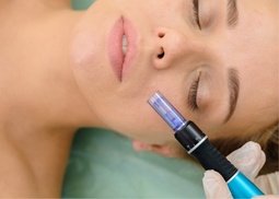 Up to 60% Off Microneedling and PRP at Skinovatio Medical Spa