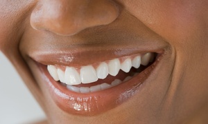 Kosmetisches Zahnbleaching Kosmetisches Zahnbleaching