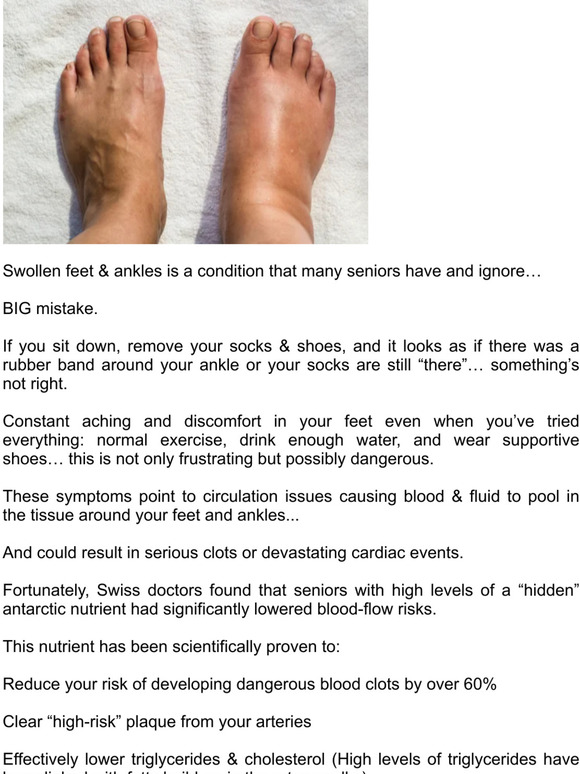 derose-health-what-swollen-feet-tell-you-about-your-heart-milled