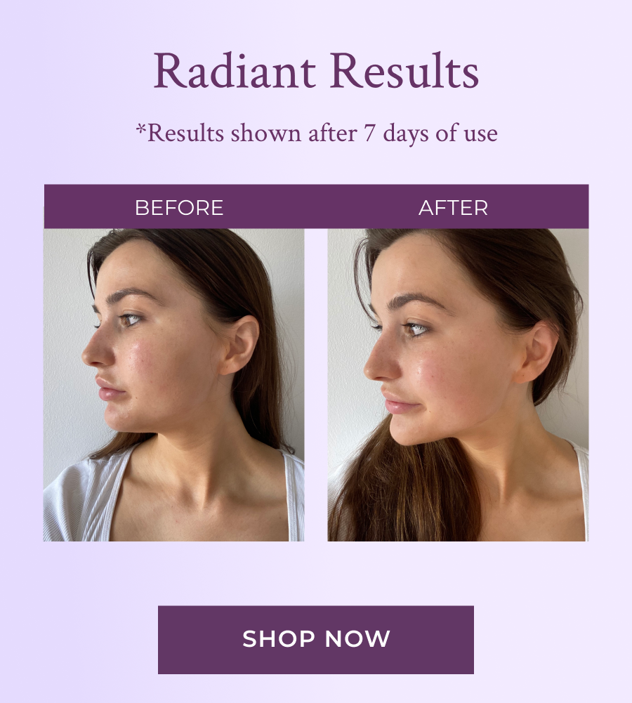Radiant Results in just 7 Days