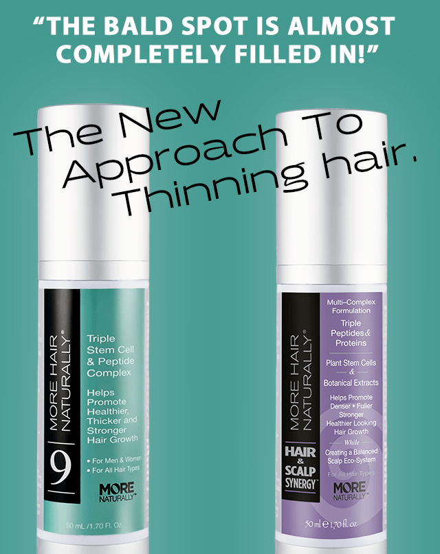 The More Hair Naturally 9 along with the Hair and Scalp Synergy is  the most aggressive approach you can take against thinning hair!