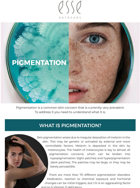 6 Tips to reduce Pigmentation ✨