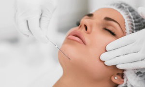 Up to 68% Off PDO Thread Lift at Skinovatio Medical Spa 